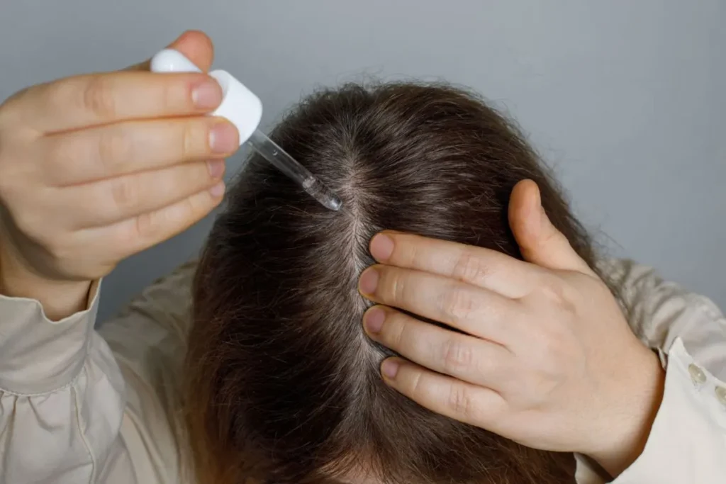 تصویر مرتبط با سرم مو چیست و چگونه به مراقبت بهتر از موها کمک می‌کند؟