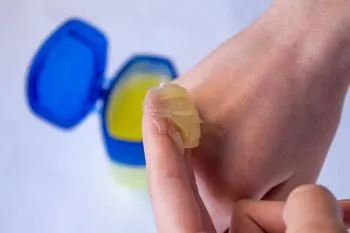 وازلین و تأثیر آن بر؛ تصویر وازلین و ساختار شیمیایی آن