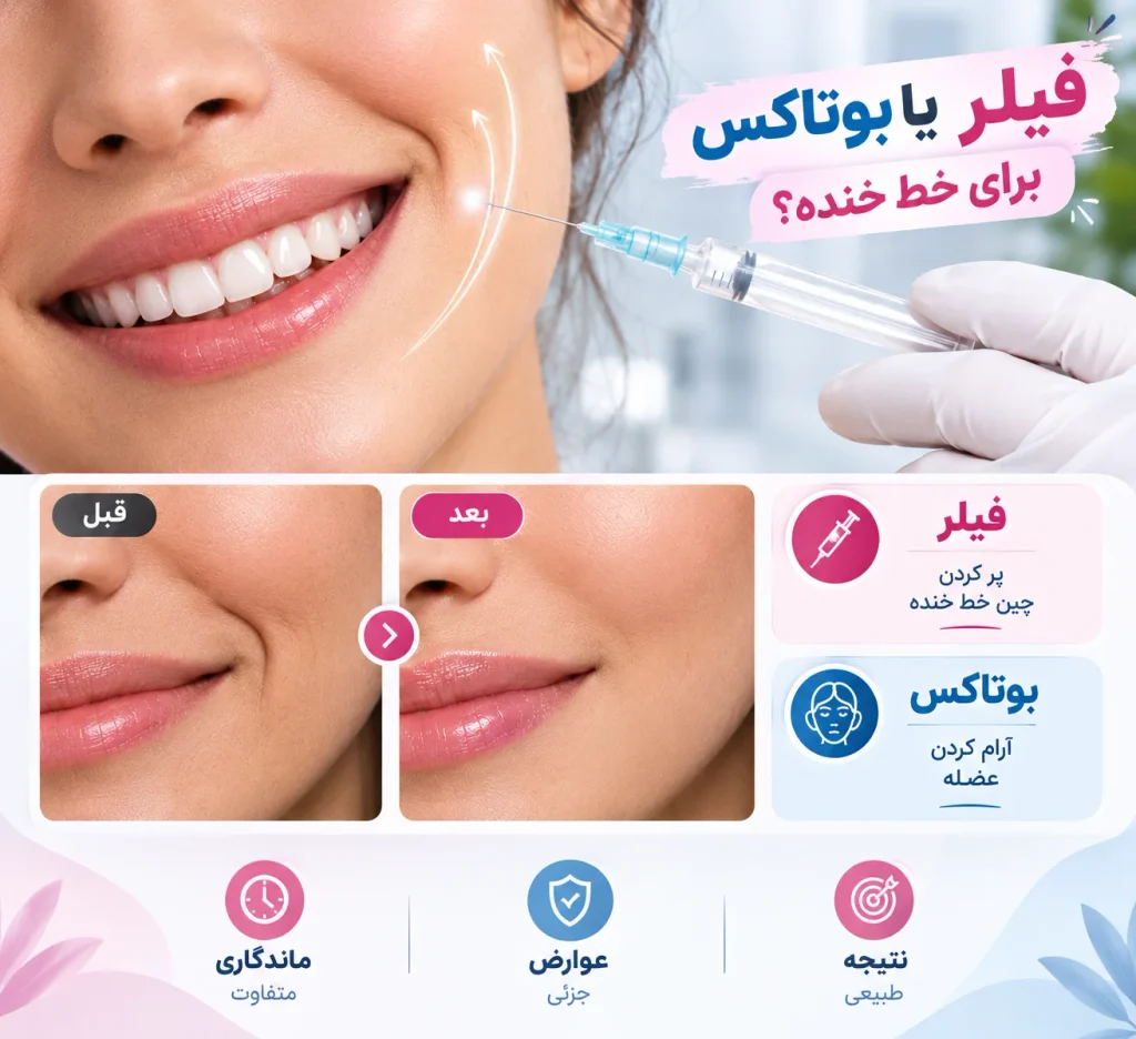فیلر بهتر است یا بوتاکس برای خط خنده؟